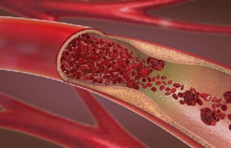 للحفاظ على الأوعية الدموية وتعزيز تدفق الدم بجسمك.. إليك أشهر 8 أطعمة