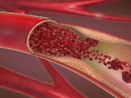 للحفاظ على الأوعية الدموية وتعزيز تدفق الدم بجسمك.. إليك أشهر 8 أطعمة